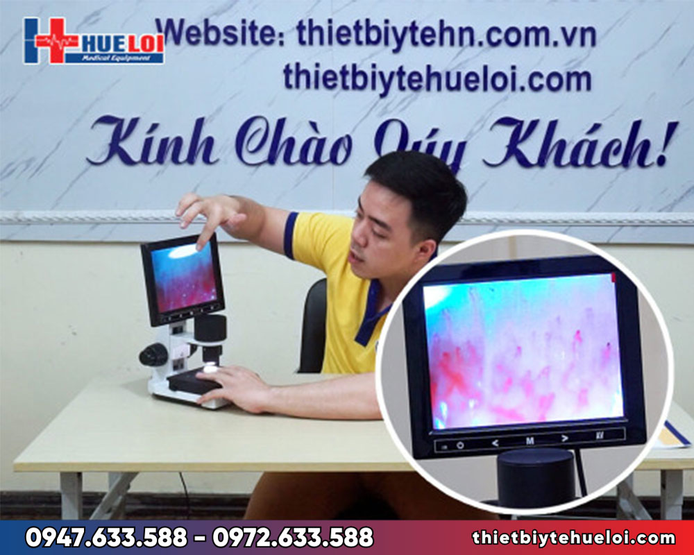 Kính hiển vi soi mao mạch